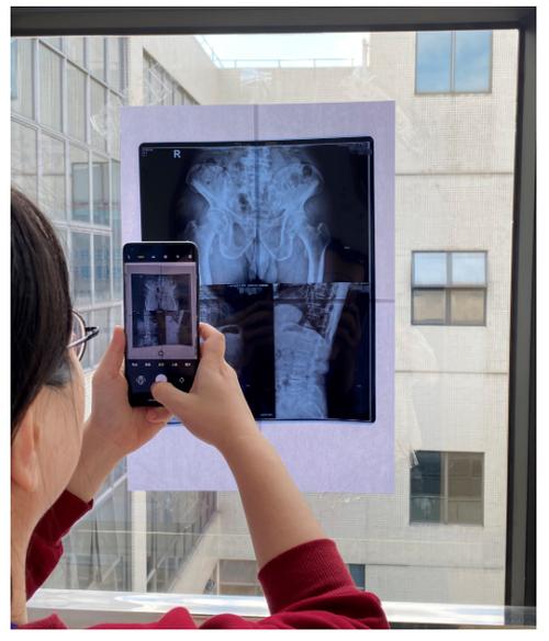 翻拍的照片怎么提高清晰度？什么软件可以修复